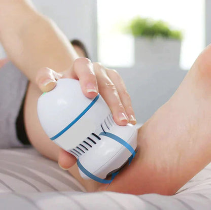 Luxetize Vacuum Callus Remover